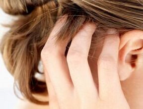 psoriāzes pazīmes un simptomi uz galvas ādas